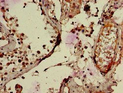 Invitrogen RNF126 Polyclonal Antibody 100 &mu;g; Unconjugated:Antibodies,