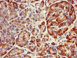 Invitrogen RNF126 Polyclonal Antibody 100 &mu;g; Unconjugated:Antibodies,
