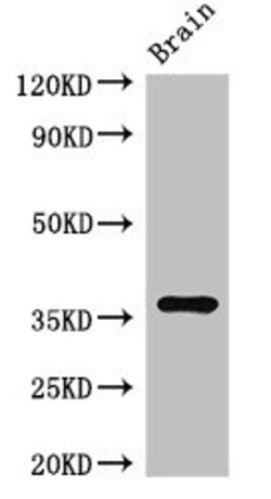 Invitrogen RNF126 Polyclonal Antibody 100 &mu;g; Unconjugated:Antibodies,