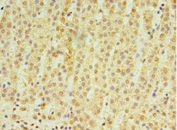 Invitrogen RNF212 Polyclonal Antibody 100 &mu;L; Unconjugated:Antibodies,