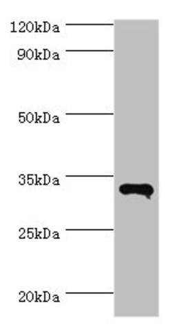 Invitrogen RNF212 Polyclonal Antibody 100 &mu;L; Unconjugated:Antibodies,
