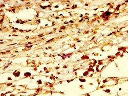 Invitrogen C13orf7 Polyclonal Antibody 100 μg; Unconjugated:Antibodies,