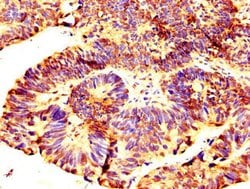 Invitrogen C13orf7 Polyclonal Antibody 100 μg; Unconjugated:Antibodies,