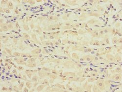 Invitrogen RPIA Polyclonal Antibody 100 &mu;L; Unconjugated:Antibodies,