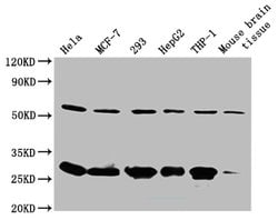 Invitrogen RPL19 Polyclonal Antibody 100 &mu;g; Unconjugated:Antibodies,