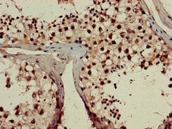 Invitrogen RPL23A Polyclonal Antibody 100 &mu;g; Unconjugated:Antibodies,