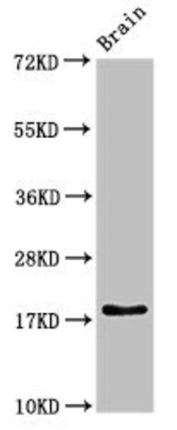 Invitrogen RPL23A Polyclonal Antibody 100 &mu;g; Unconjugated:Antibodies,