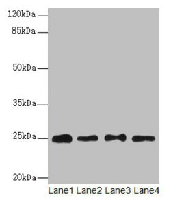 Invitrogen RPS8 Polyclonal Antibody 100 &mu;g; Unconjugated:Antibodies,