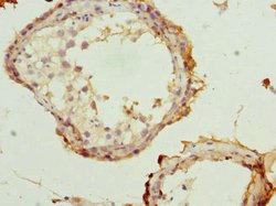 Invitrogen Rhotekin Polyclonal Antibody 100 μL; Unconjugated:Antibodies,