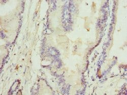 Invitrogen Rhotekin Polyclonal Antibody 100 μL; Unconjugated:Antibodies,