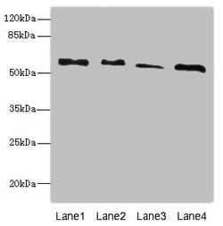 Invitrogen Rhotekin Polyclonal Antibody 100 μL; Unconjugated:Antibodies,
