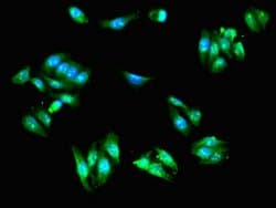 Invitrogen SCIN Polyclonal Antibody 100 &mu;g; Unconjugated:Antibodies,