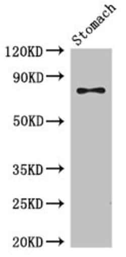 Invitrogen SCIN Polyclonal Antibody 100 &mu;g; Unconjugated:Antibodies,