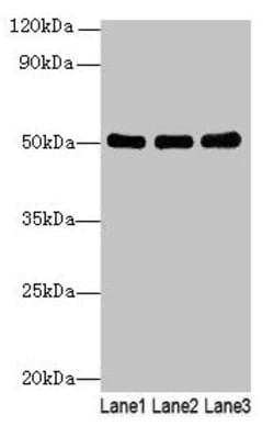 Invitrogen SIGLEC6 Polyclonal Antibody 100 &mu;g; Unconjugated:Antibodies,