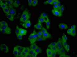 Invitrogen SLC11A1 Polyclonal Antibody 100 &mu;g; Unconjugated:Antibodies,