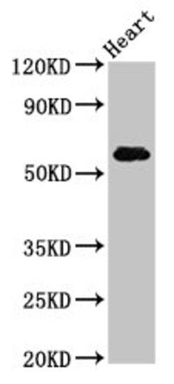 Invitrogen SLC11A1 Polyclonal Antibody 100 &mu;g; Unconjugated:Antibodies,