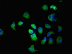 Invitrogen SLC22A2 Polyclonal Antibody 100 μg; Unconjugated:Antibodies,