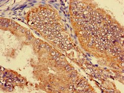 Invitrogen SLC22A2 Polyclonal Antibody 100 μg; Unconjugated:Antibodies,