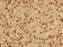Invitrogen SLC22A2 Polyclonal Antibody 100 μg; Unconjugated:Antibodies,