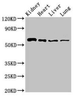 Invitrogen SLC22A2 Polyclonal Antibody 100 μg; Unconjugated:Antibodies,