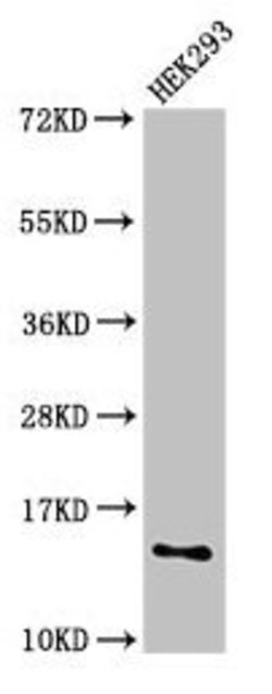 Invitrogen SNRPD1 Polyclonal Antibody 100 &mu;g; Unconjugated:Antibodies,