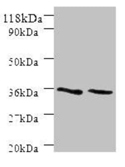 Invitrogen SNX20 Polyclonal Antibody 100 μg; Unconjugated:Antibodies,
