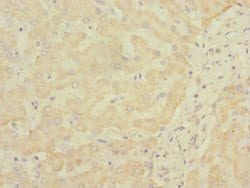 Invitrogen SOAT2 Polyclonal Antibody 100 &mu;L; Unconjugated:Antibodies,