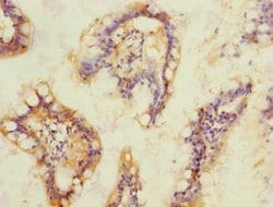 Invitrogen SOAT2 Polyclonal Antibody 100 &mu;L; Unconjugated:Antibodies,