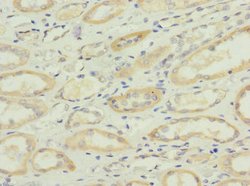 Invitrogen SQRDL Polyclonal Antibody 100 &mu;L; Unconjugated:Antibodies,