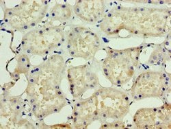 Invitrogen SSSCA1 Polyclonal Antibody 100 &mu;g; Unconjugated:Antibodies,