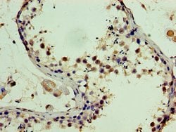 Invitrogen SSSCA1 Polyclonal Antibody 100 &mu;g; Unconjugated:Antibodies,