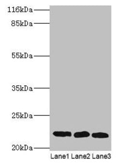 Invitrogen SSSCA1 Polyclonal Antibody 100 &mu;g; Unconjugated:Antibodies,