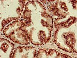 Invitrogen ST8SIA5 Polyclonal Antibody 100 &mu;g; Unconjugated:Antibodies,