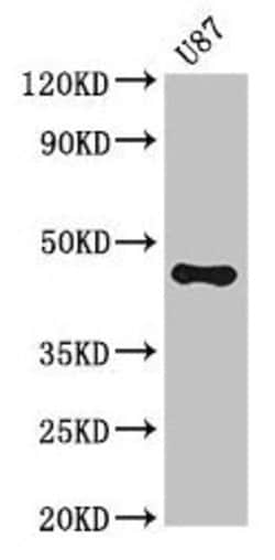 Invitrogen ST8SIA5 Polyclonal Antibody 100 &mu;g; Unconjugated:Antibodies,