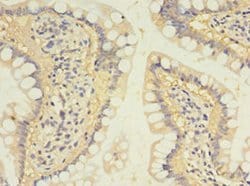 Invitrogen SULT1B1 Polyclonal Antibody 100 &mu;g; Unconjugated:Antibodies,