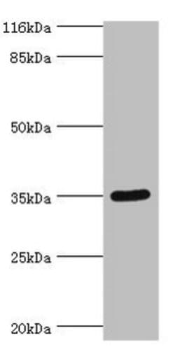 Invitrogen SULT1B1 Polyclonal Antibody 100 &mu;g; Unconjugated:Antibodies,