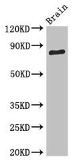 Invitrogen SV2B Polyclonal Antibody 100 &mu;g | Buy Online | Invitrogen&trade; | Fisher Scientific