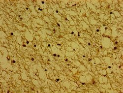 Invitrogen Synaptoporin Polyclonal Antibody 100 &mu;g; Unconjugated:Antibodies,