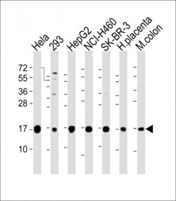 Invitrogen IFITM3 Polyclonal Antibody 400 &mu;L; Unconjugated:Antibodies,