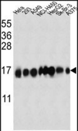 Invitrogen IFITM3 Polyclonal Antibody 400 &mu;L; Unconjugated:Antibodies,