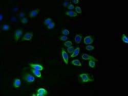 Invitrogen TMEM14A Polyclonal Antibody 100 &mu;g; Unconjugated:Antibodies,