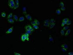 Invitrogen TMEM14B Polyclonal Antibody 100 &mu;g; Unconjugated:Antibodies,