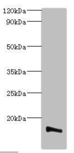 Invitrogen TMEM14B Polyclonal Antibody 100 &mu;g; Unconjugated:Antibodies,