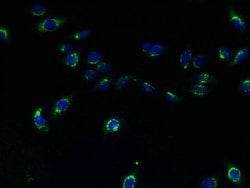 TMEM165 Polyclonal Antibody:Antibodies, Polyclonal