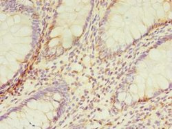 TMEM165 Polyclonal Antibody:Antibodies, Polyclonal