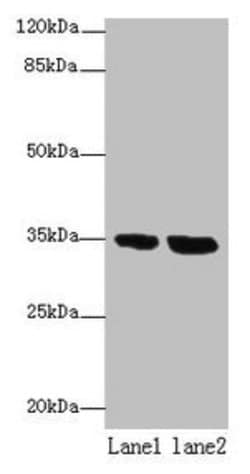 TMEM165 Polyclonal Antibody:Antibodies, Polyclonal