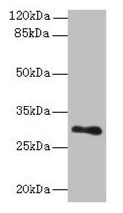 Invitrogen T176B Polyclonal Antibody 100 &mu;g | Buy Online | Invitrogen&trade; | Fisher Scientific