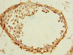Invitrogen TMEM186 Polyclonal Antibody 100 μg; Unconjugated:Antibodies,