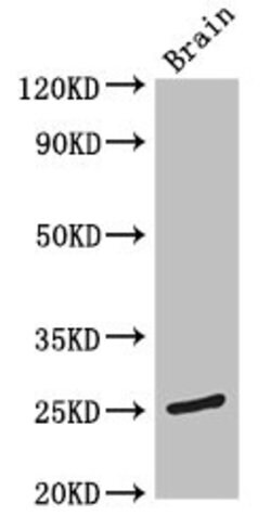 Invitrogen TMEM186 Polyclonal Antibody 100 μg; Unconjugated:Antibodies,