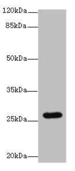 Invitrogen TMEM217 Polyclonal Antibody 100 &mu;g; Unconjugated:Antibodies,